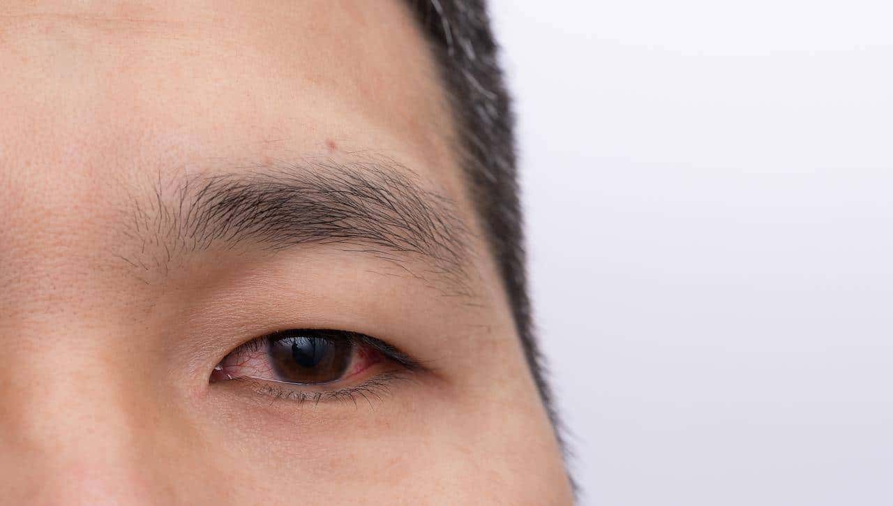 警惕！老年带状疱疹不止是疼，3大致命并发症要当心