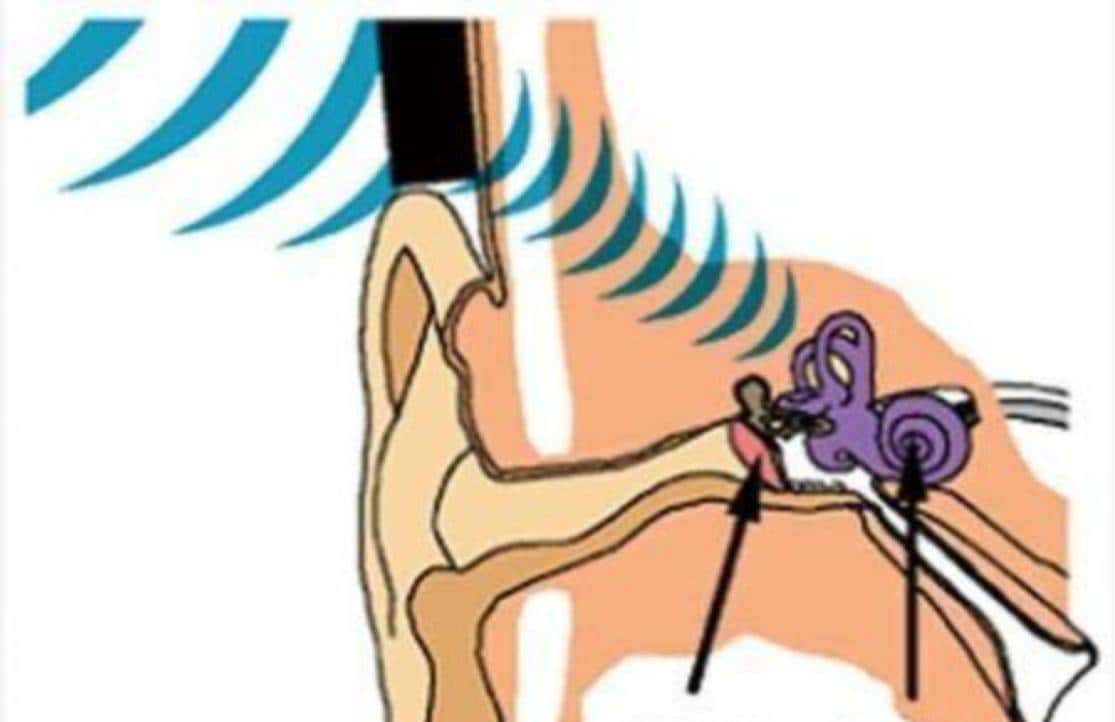 2022骨传导耳机哪个牌子好?一文读懂:如何选择骨传导耳机