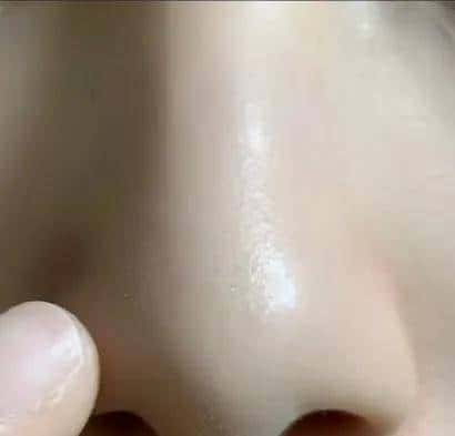 黄皮救命!维生素E擦脸,色斑暗沉7天退退退