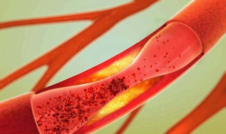 ED 用药别花冤枉钱!4 代药物对比,医保报销 + 疗效性价比排名