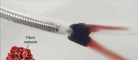 输液时抽出“虾线”状血条，是血栓吗？！我还有救吗……