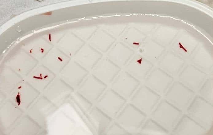 输液时抽出“虾线”状血条，是血栓吗？！我还有救吗……