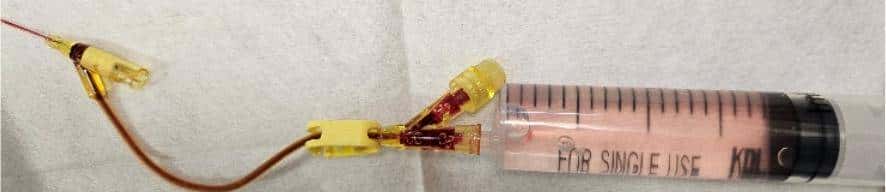 输液时抽出“虾线”状血条!?我还有救吗……