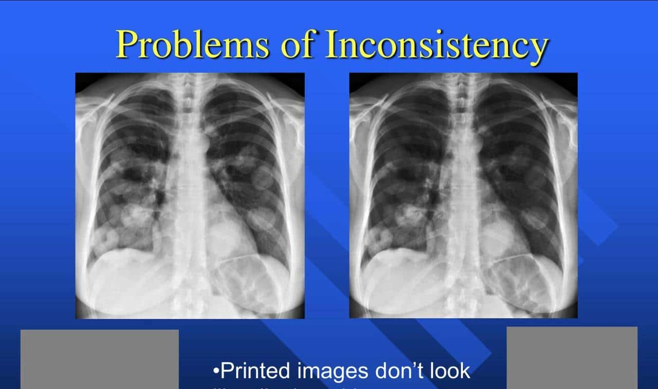 DeepseekOCR到底做了什么?