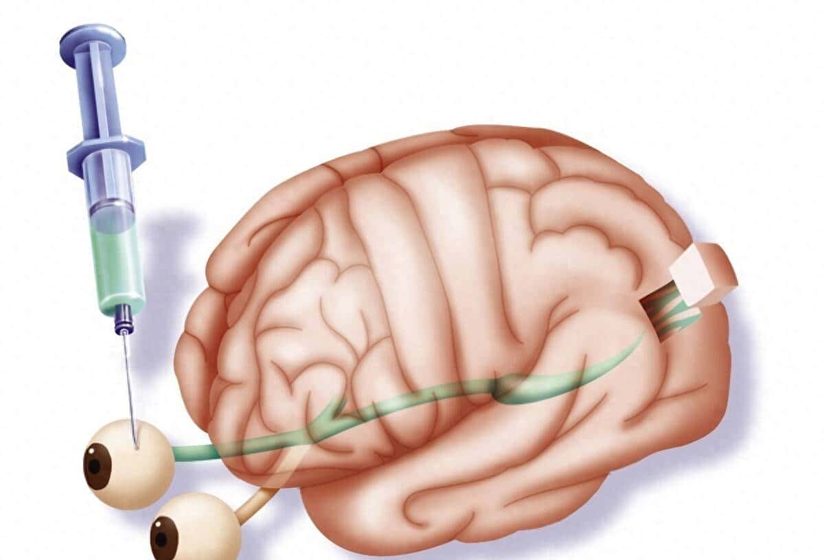 “眼+耳+脑”综合征有哪些？