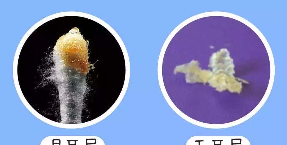 讲讲怎样给娃清理耳屎、啥时要去医院等，做到遇屎不乱