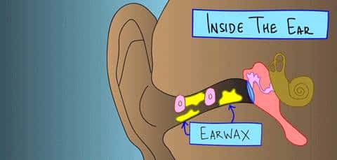讲讲怎样给娃清理耳屎、啥时要去医院等，做到遇屎不乱
