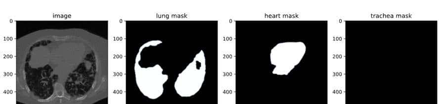 微调自己的SAM 2 分割模型