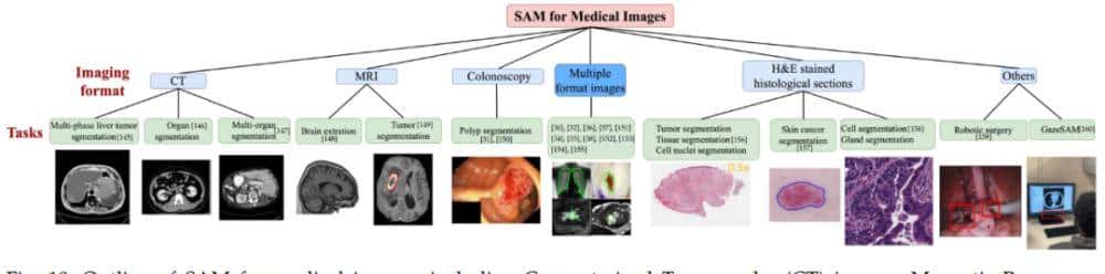 分割一切模型SAM首篇全面综述：28页、200＋篇参考文献