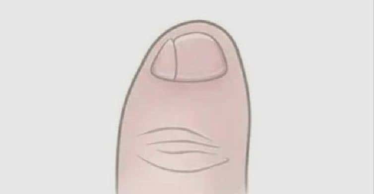 小脚趾拥有两瓣甲的人,是纯种汉人?他们到底是何来历?