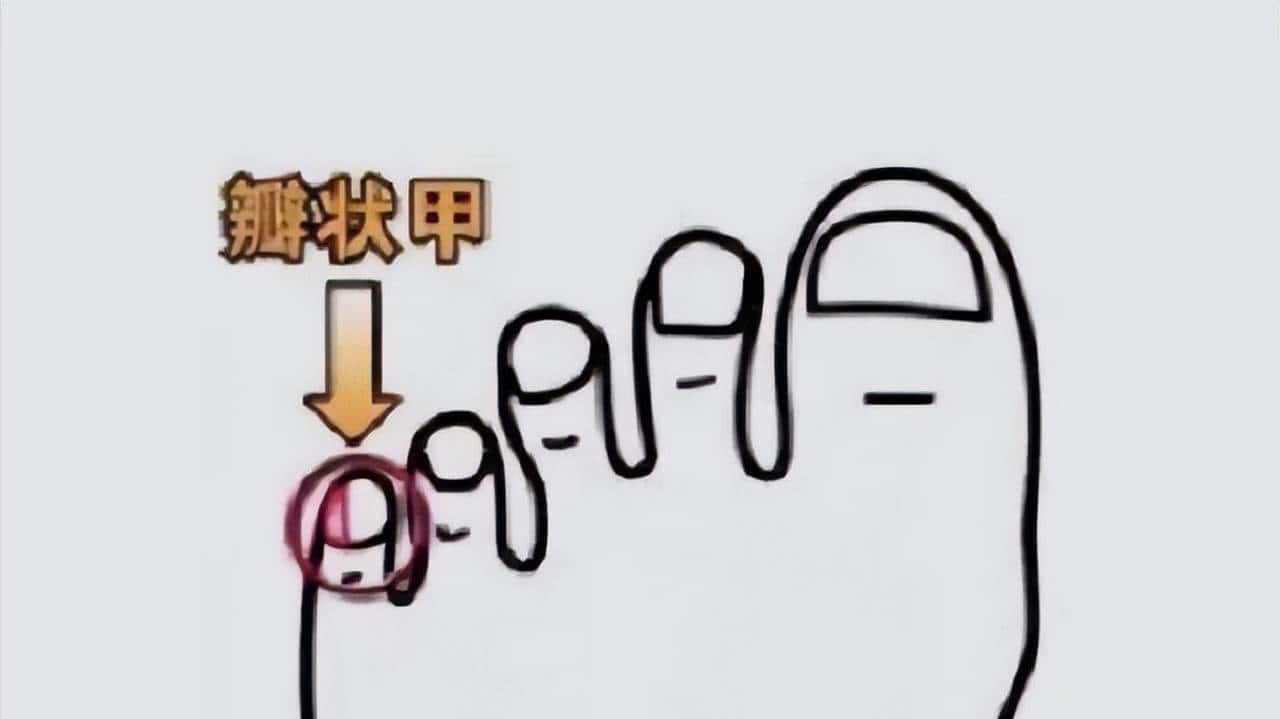 小脚趾拥有两瓣甲的人,是纯种汉人?他们到底是何来历?