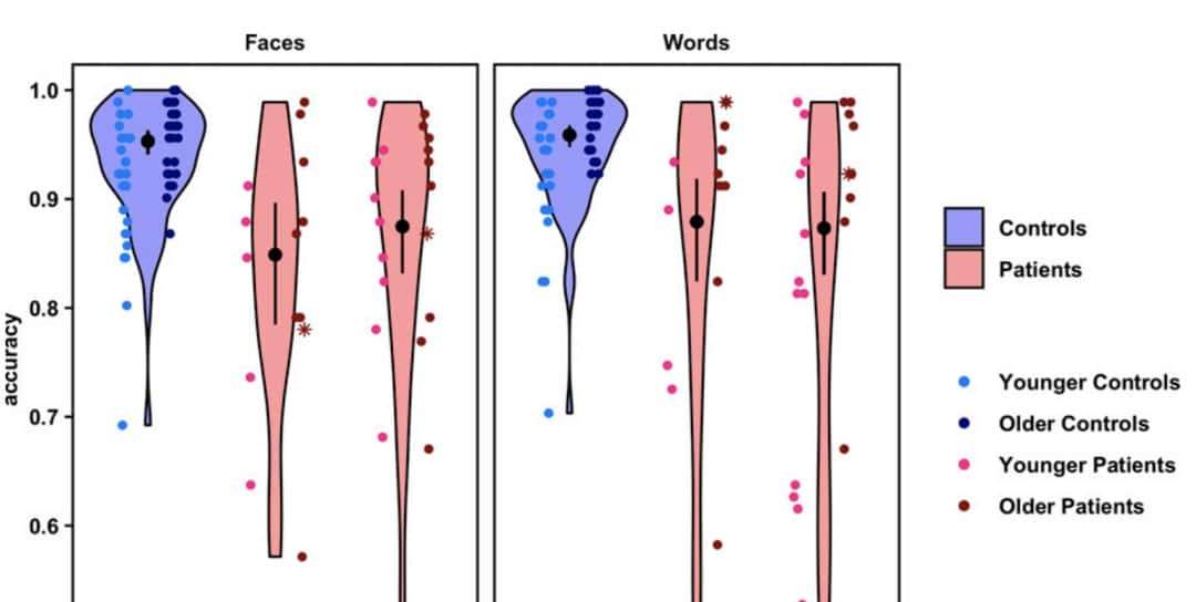 只剩半个大脑,人识字看脸准确率竟还能达80% | PNAS