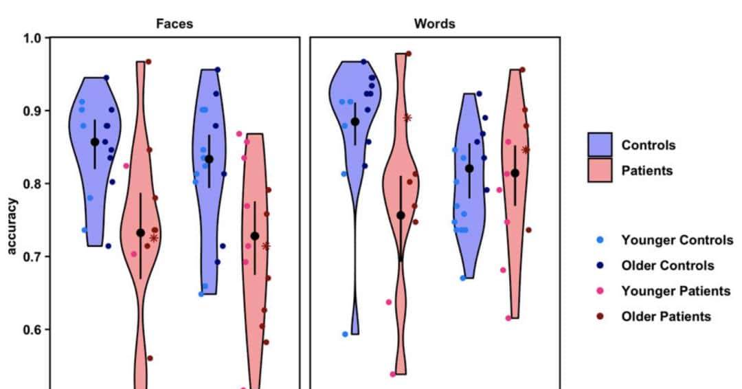只剩半个大脑,人识字看脸准确率竟还能达80% | PNAS