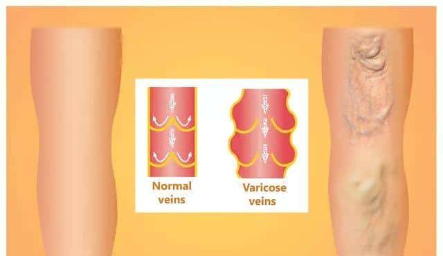 久坐引起的腰酸背痛，你以为站着就能解决？