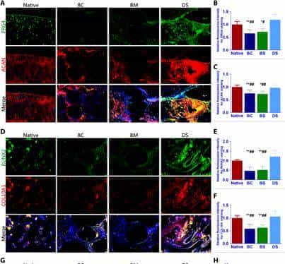 打破软骨不可再生壁垒,《Science》子刊:具有双因子释放和梯度结构3D生物打印构建体,用于异质软骨再生