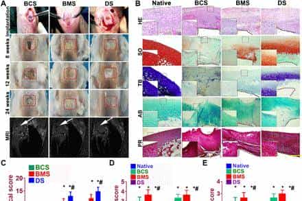 打破软骨不可再生壁垒,《Science》子刊:具有双因子释放和梯度结构3D生物打印构建体,用于异质软骨再生