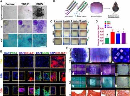 打破软骨不可再生壁垒,《Science》子刊:具有双因子释放和梯度结构3D生物打印构建体,用于异质软骨再生