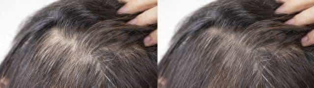 这些洗发水别动！他们是你头发稀疏的凶手！