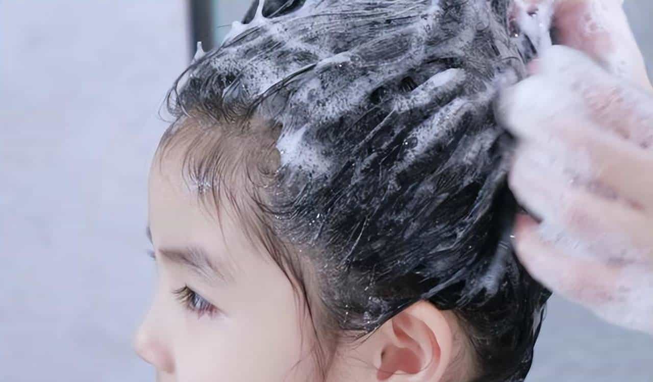 35岁男子头发稀疏,查成分发现罪魁祸首,90家庭都在用