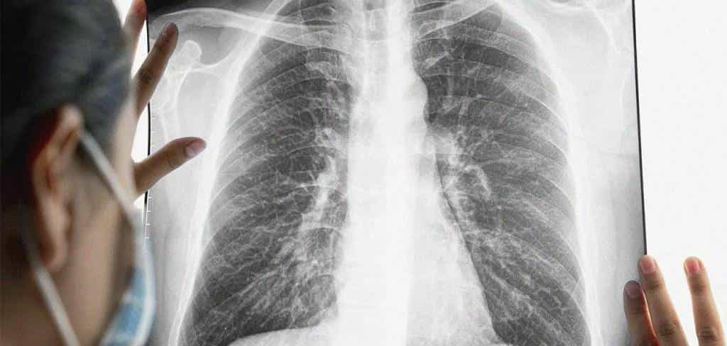 肺癌「双王组合」T药获批上市，超70%患者受益，免疫耐药也有效！