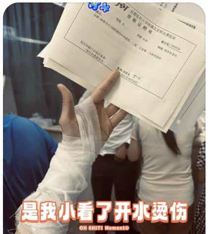 烫伤急救的 5 个步骤，许多人第一步就错了！（内附正确方法