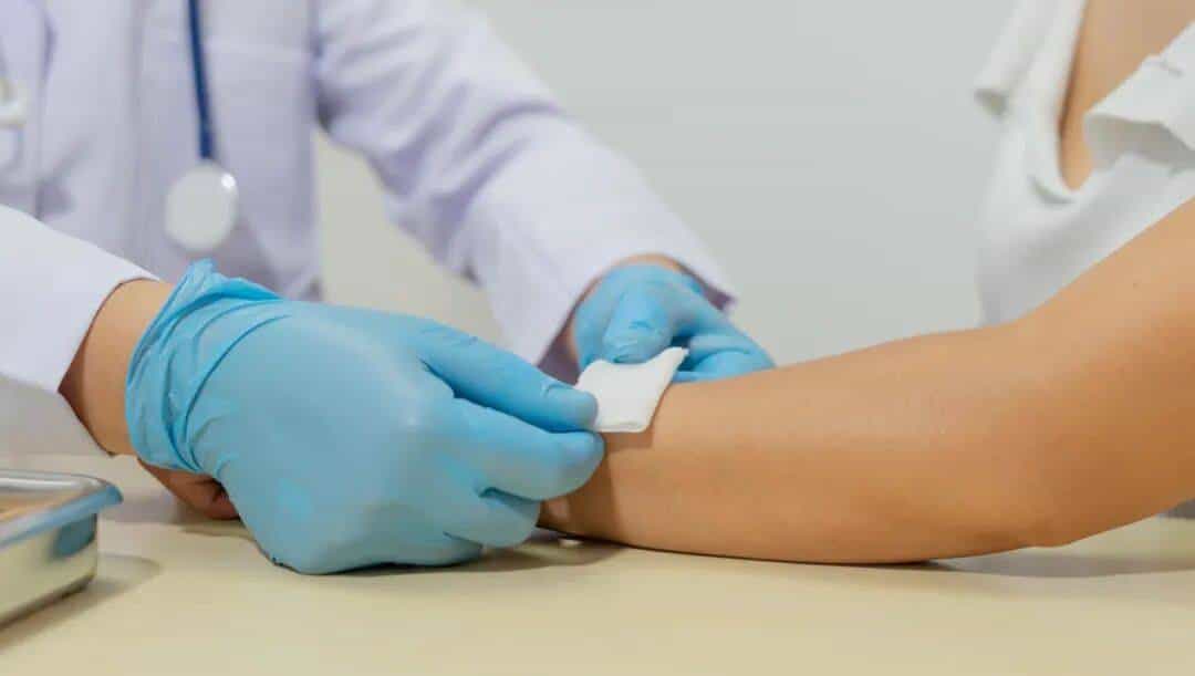 烫伤急救的 5 个步骤，许多人第一步就错了！（内附正确方法