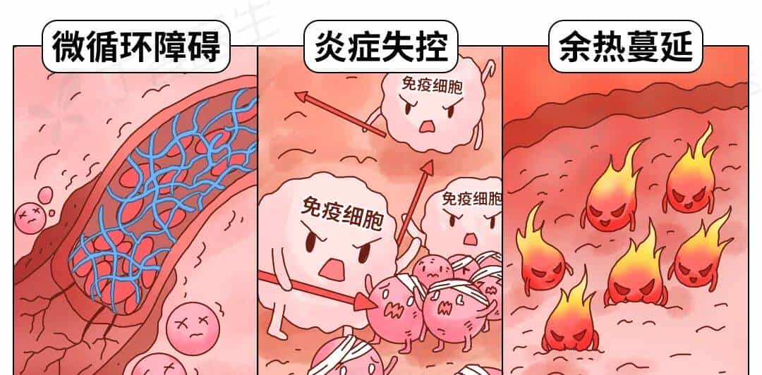 烫伤急救的 5 个步骤，许多人第一步就错了！（内附正确方法