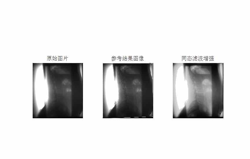 MATLAB环境下使用同态滤波方法进行医学图像增强