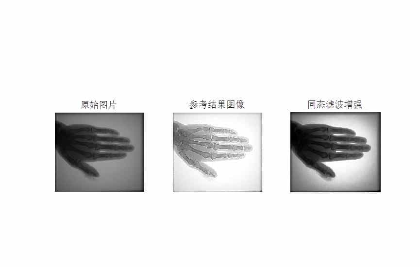 MATLAB环境下使用同态滤波方法进行医学图像增强