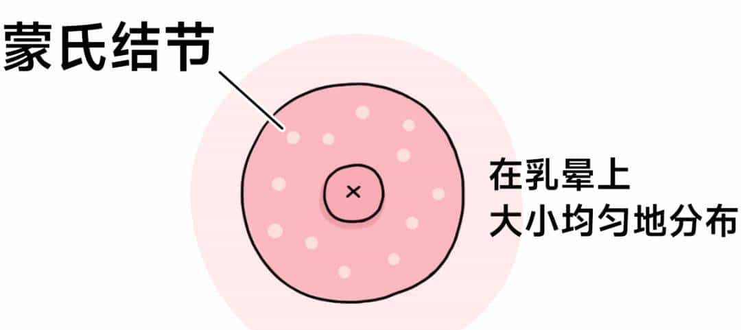 乳晕上的小颗粒,到底是啥啊?