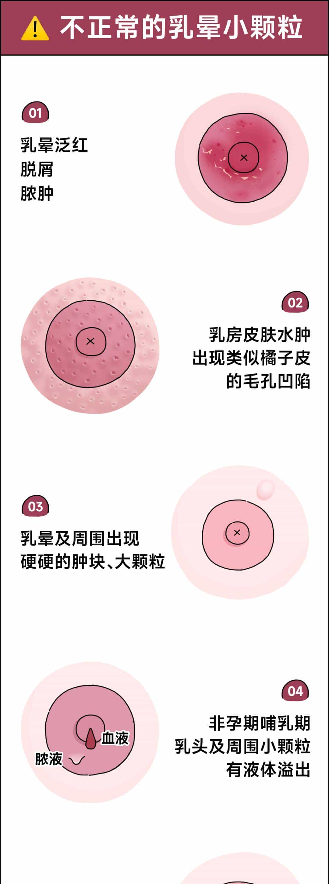 乳晕上的小颗粒,到底是啥啊?