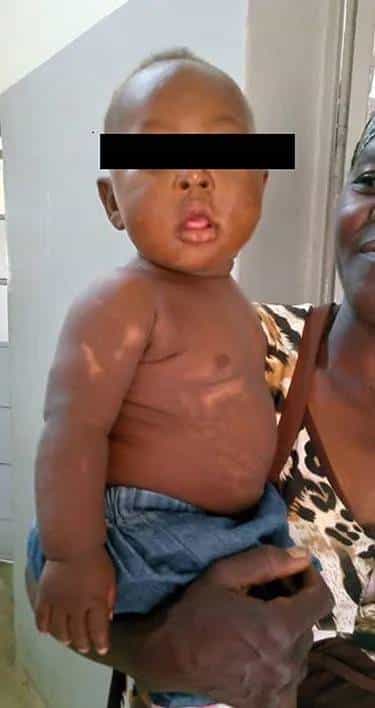 外国女婴刚出生就被母亲活埋，被埋了整整6小时，奇迹生还