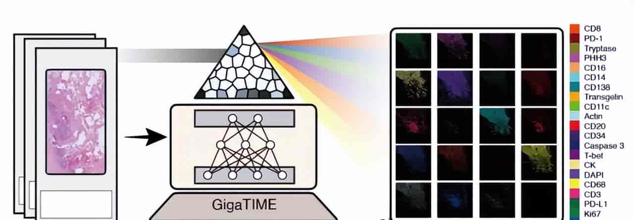 Cell重磅！微软开源首个AI肿瘤免疫模型，一键看穿癌症底细！