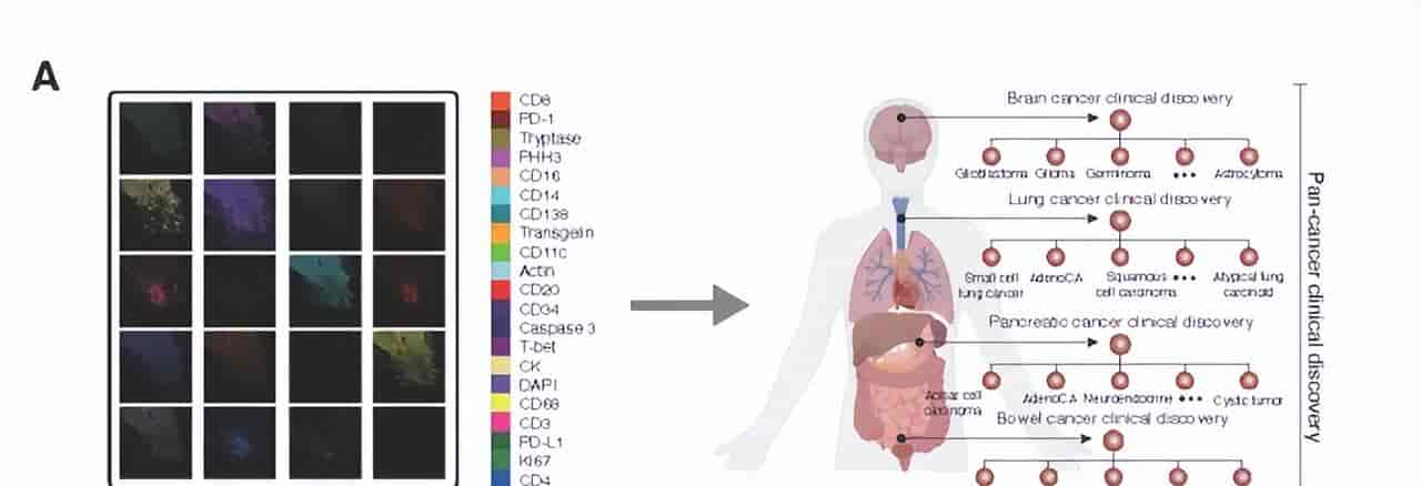 Cell重磅！微软开源首个AI肿瘤免疫模型，一键看穿癌症底细！