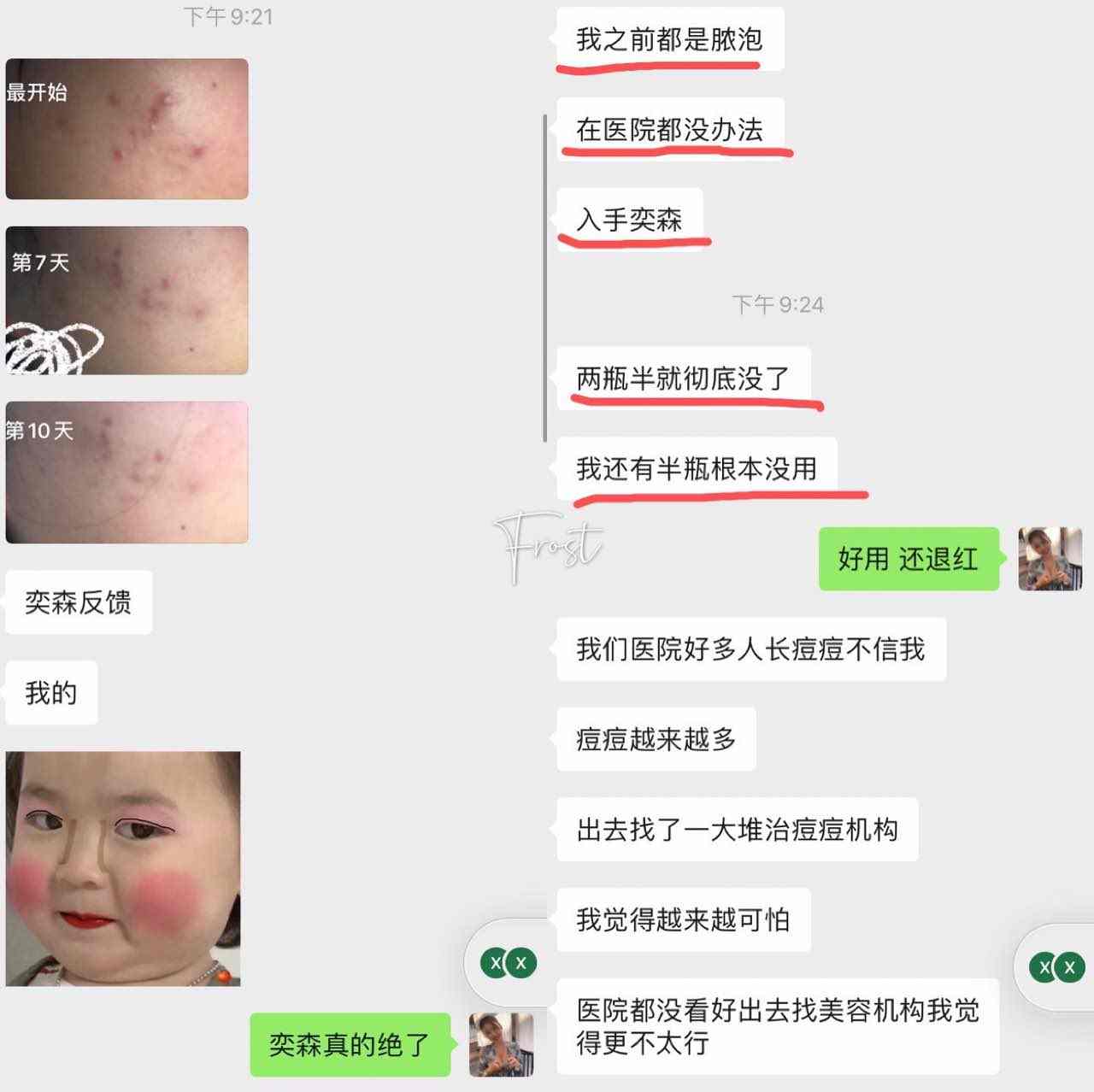 奕森祛痘精华液修颜源码20ml仪痤疮粉刺黑头痘印弈森水凝胶正品