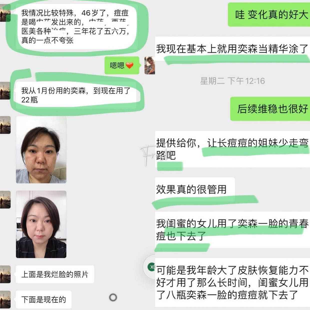 奕森祛痘精华液修颜源码20ml仪痤疮粉刺黑头痘印弈森水凝胶正品